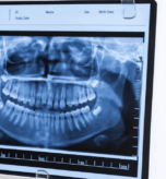Dental Cassette