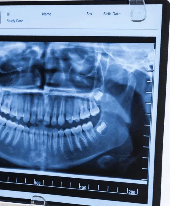 Dental Cassette
