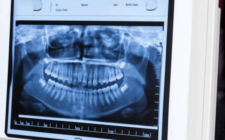 Dental Cassette