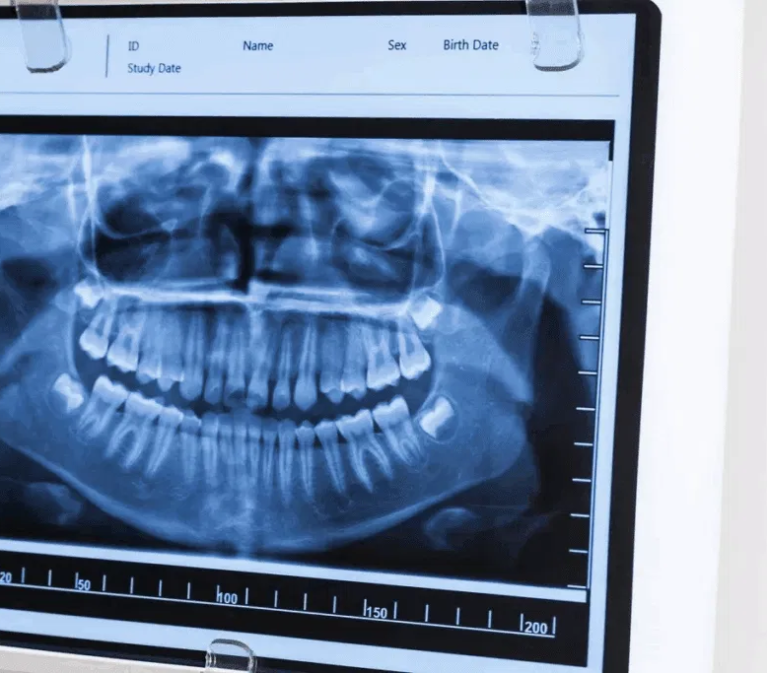 Dental Cassette